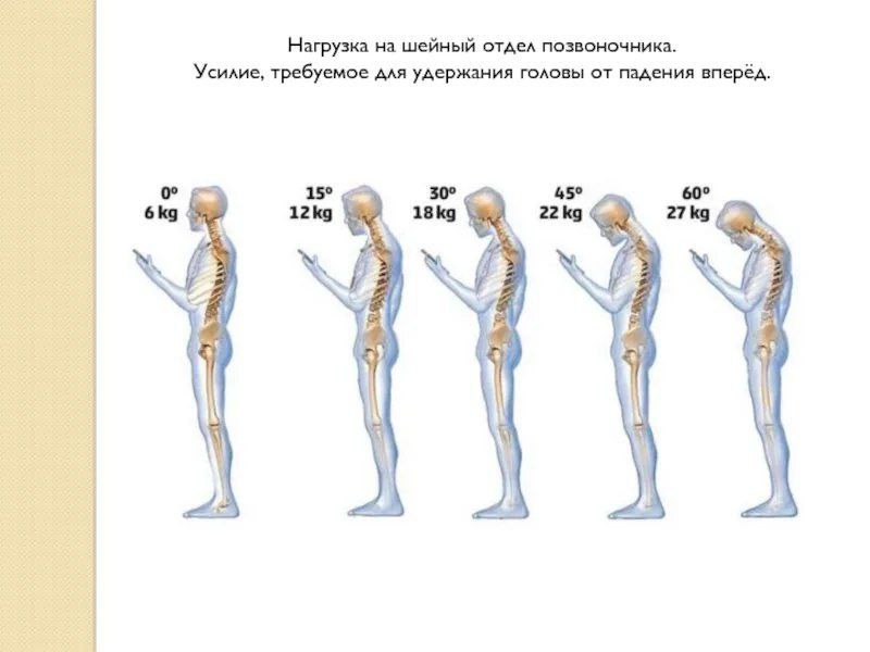 Как телефоны калечат нашу шею

Голова взрослого человека весит примерно 5-6 кг.